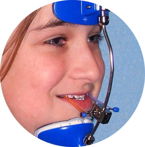 Myofunctional Appliances