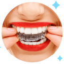 Clear invisible aligners